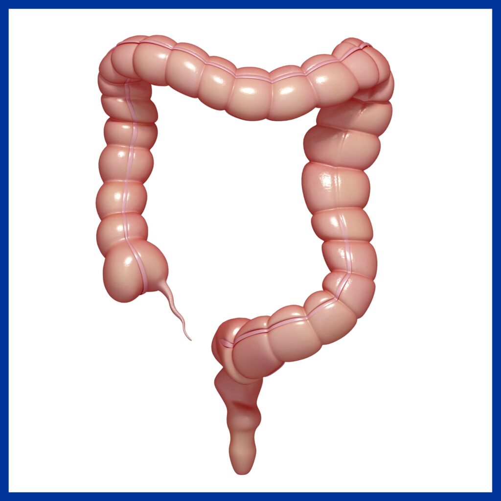 Large Intistine Word Large Intestine Disease - Best Gastroenterology Hospital in India