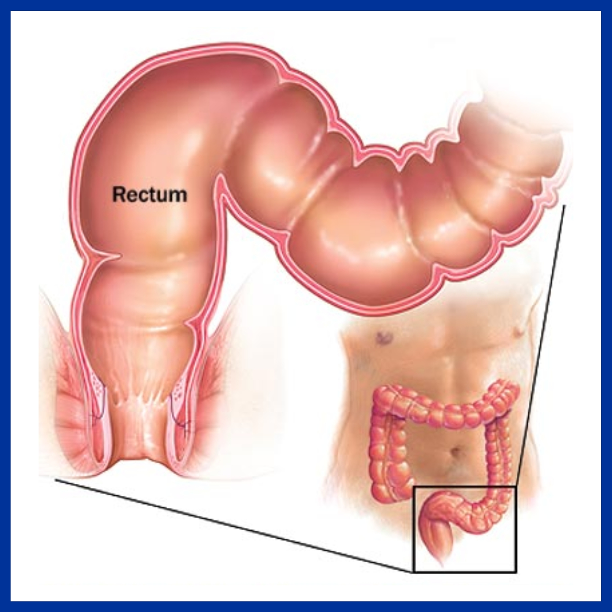 Rectum