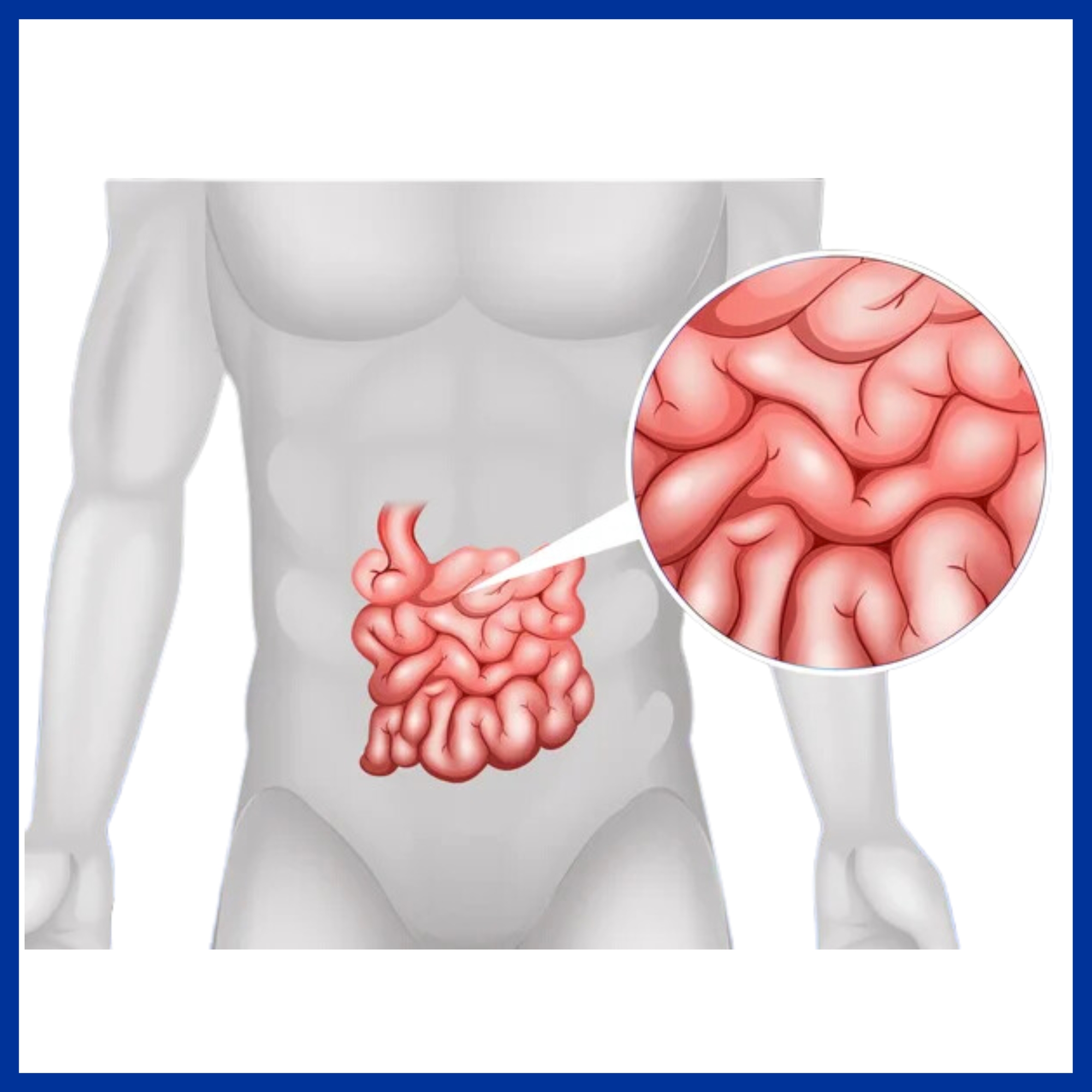 Small Intestine Disease