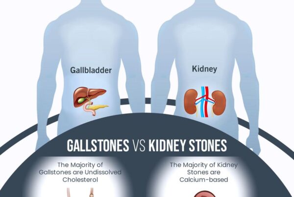 gallstone kidney stone