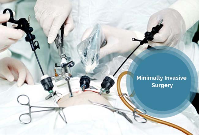 What Is Minimally Invasive Surgery ??