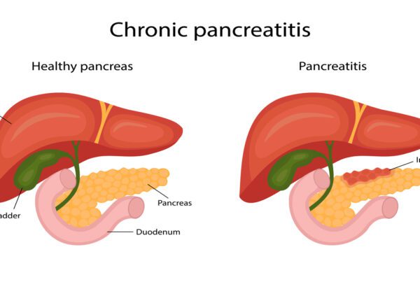 pancreatitis disease