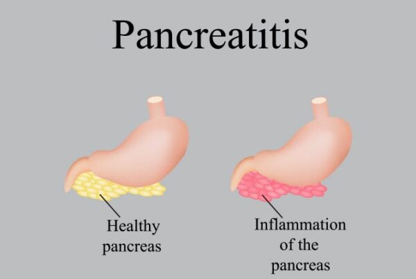 Pancreatitis