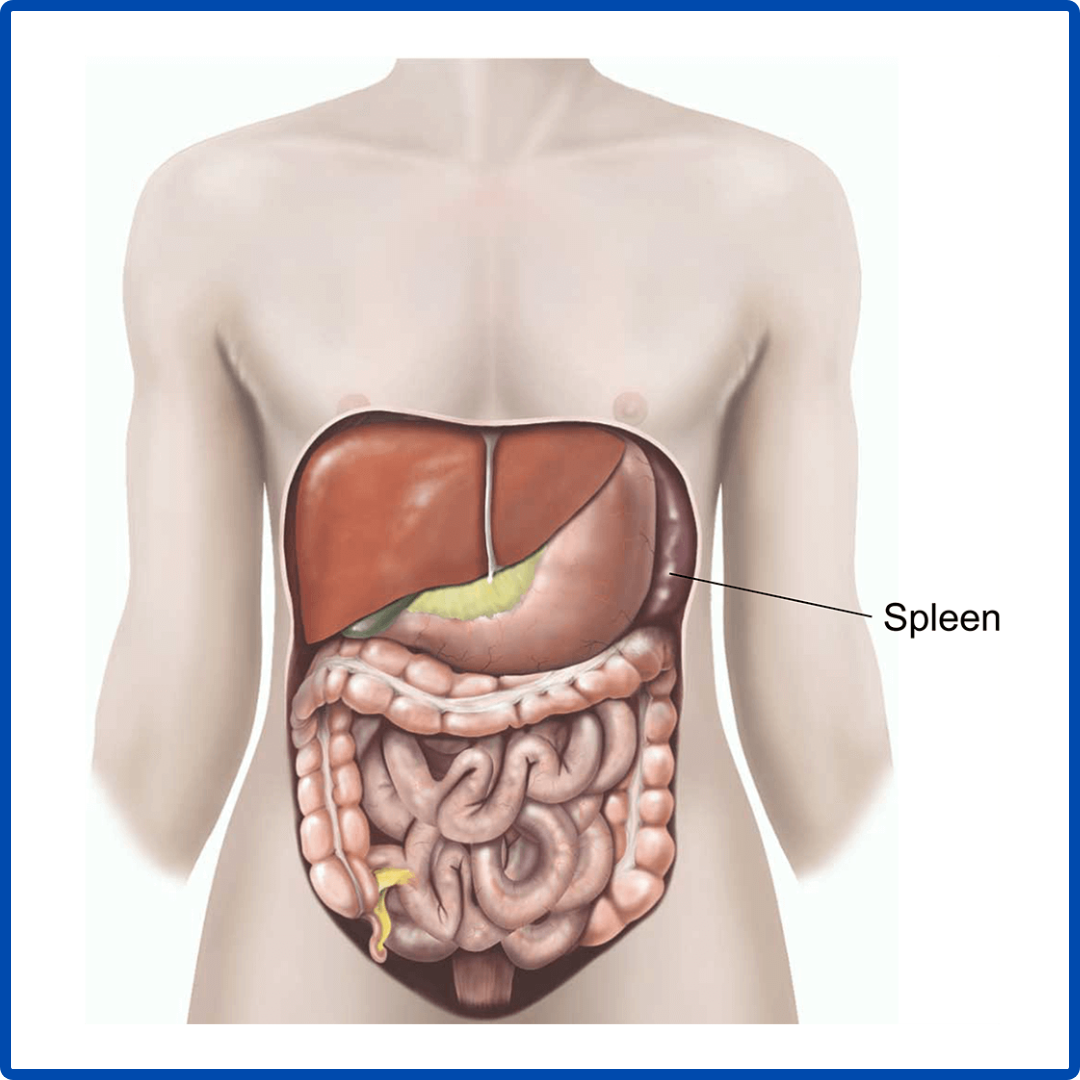 Robotic Spleen Surgery | Kaizen Hospital