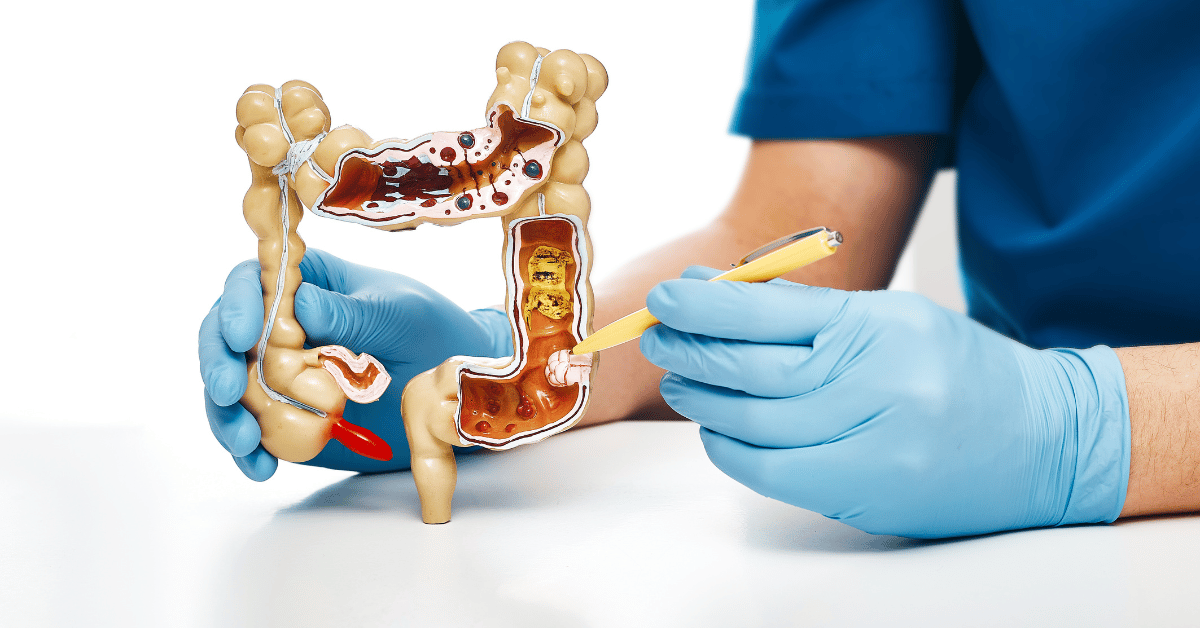 Appendicitis - symptoms, treatments and causes