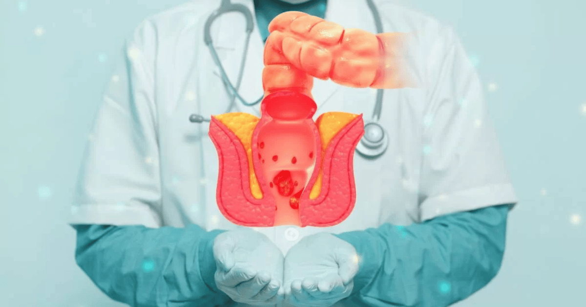 What Is a Proctologist, and What Do They Treat?