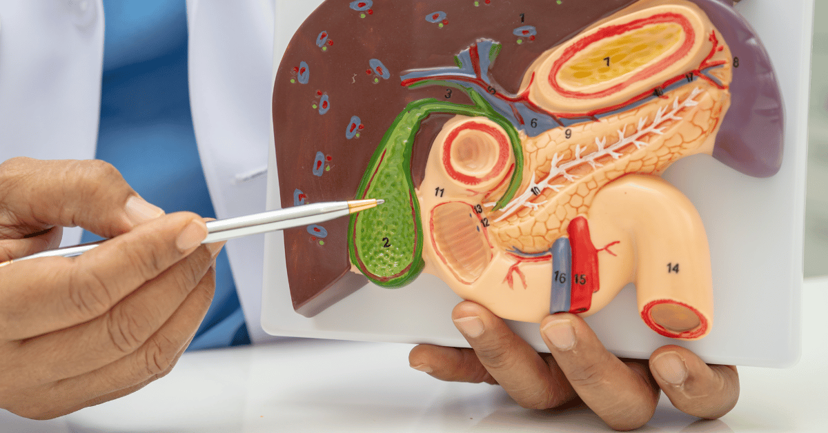 Understanding and Managing Gallbladder Stones