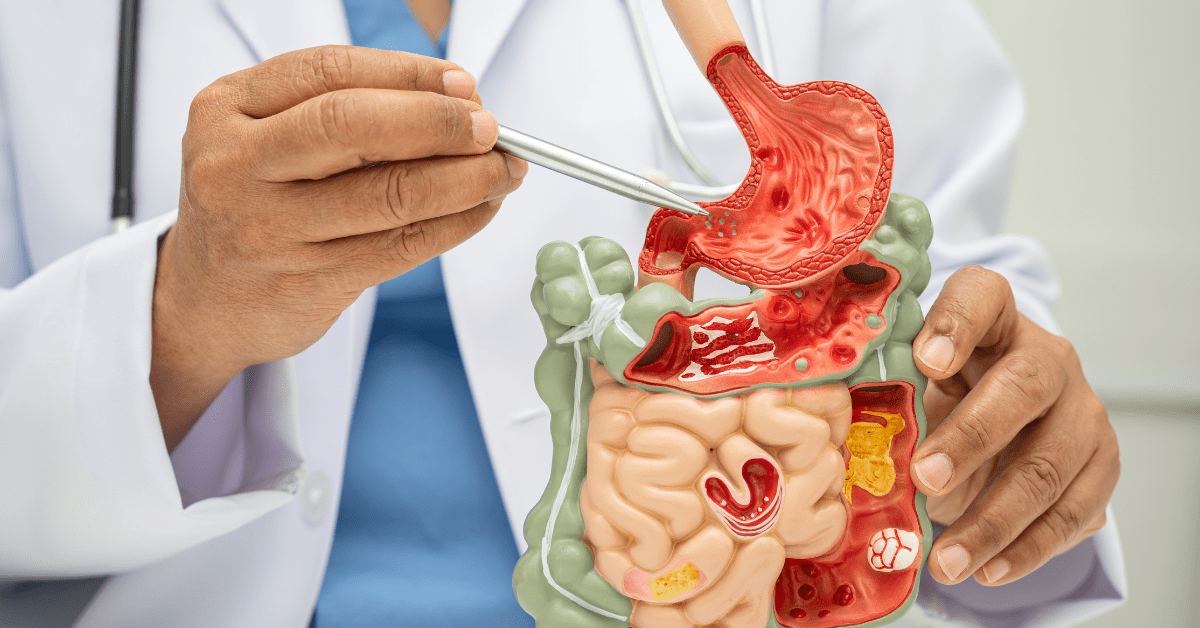 Gastro Surgeon in India