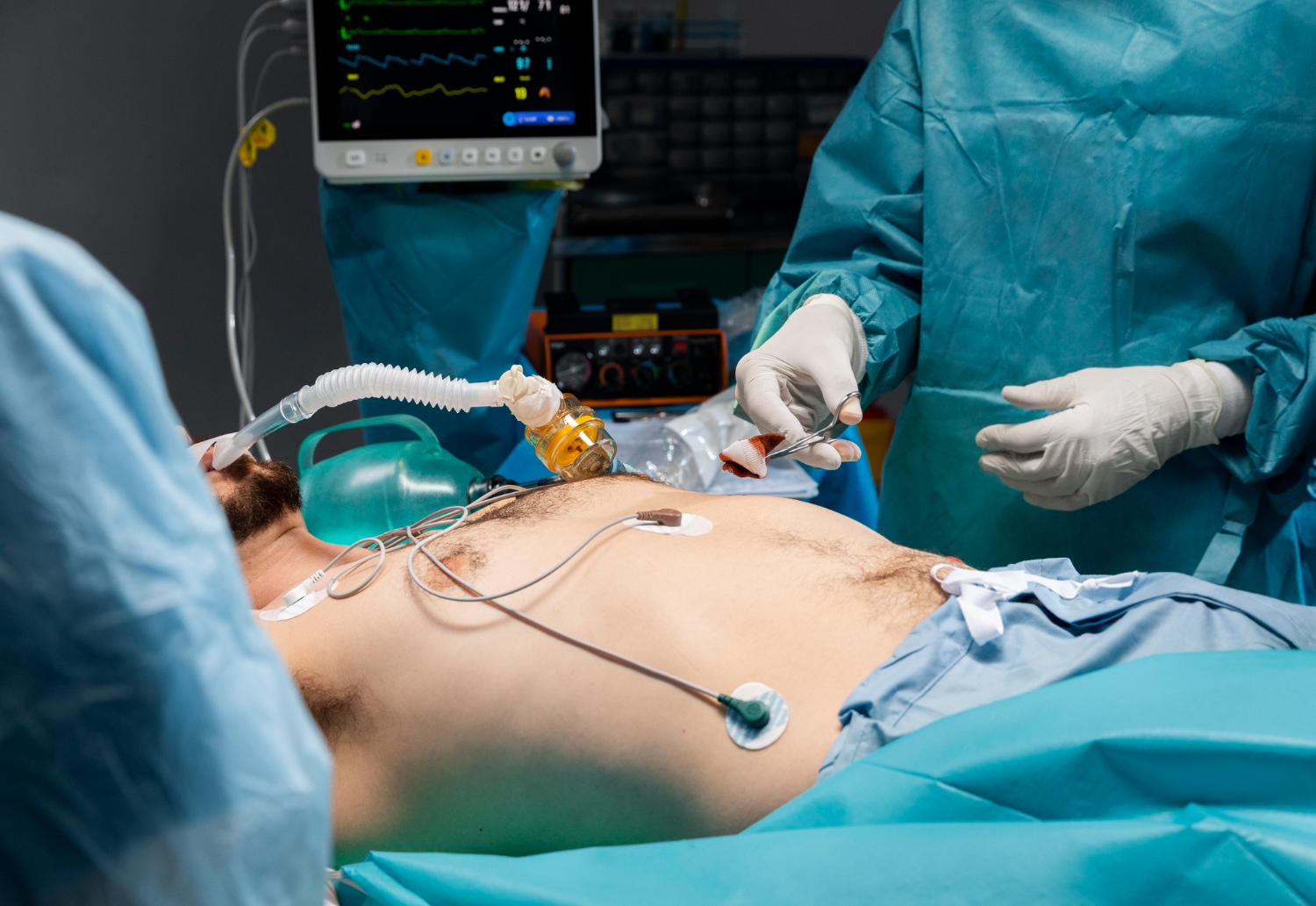 Robotic Gallbladder Surgery