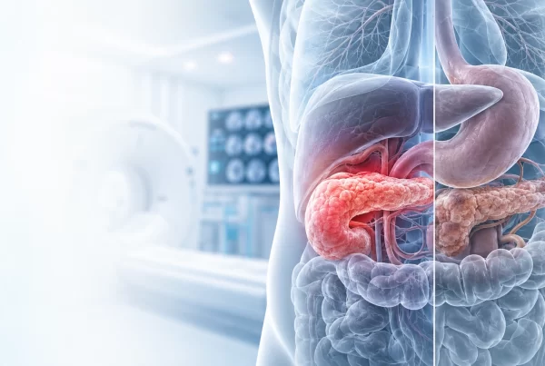 Acute vs Chronic Pancreatitis: Key Differences Explained