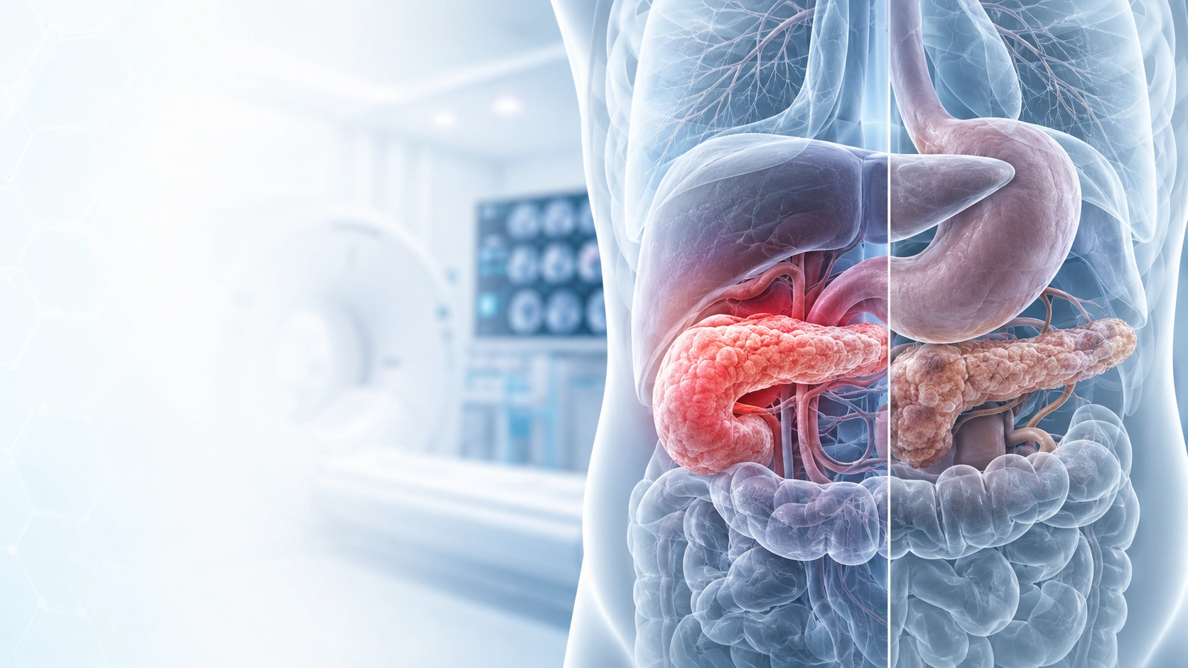 Acute vs Chronic Pancreatitis: Key Differences Explained