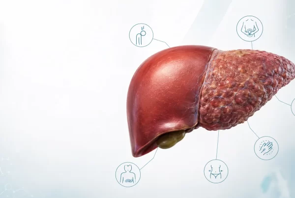 Liver Cirrhosis: Early Signs You Should Never Ignore
